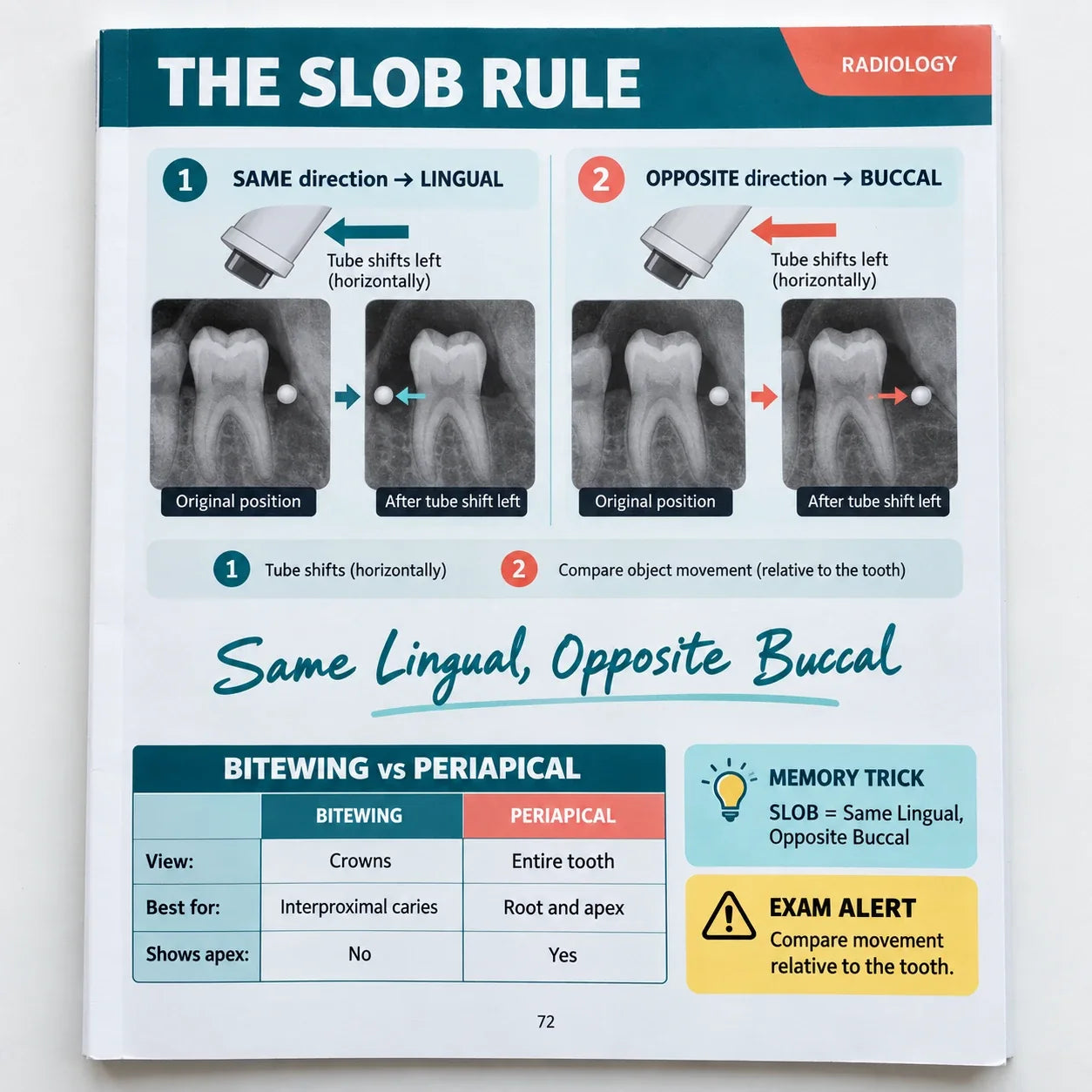 Dental radiology page explaining the SLOB rule with tube shift diagrams