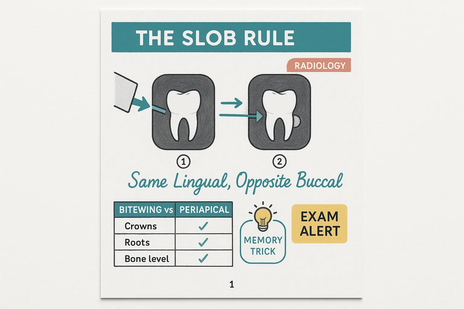 Dental radiology page explaining the SLOB rule with tube shift diagrams
