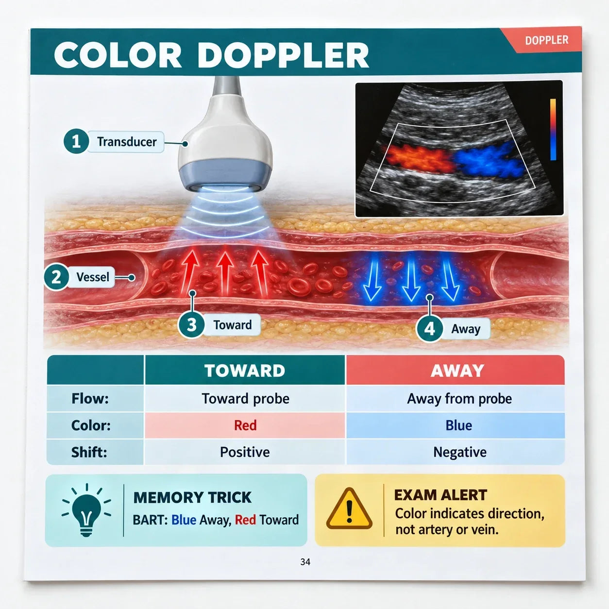 Color Doppler page: flow toward and away from the transducer